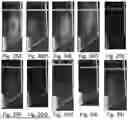 Fig. 31 - DEVICE AND METHOD FOR AEROSOLIZED DELIVERING OF SUBSTANCE TO A NATURAL ORIFICE OF THE BODY