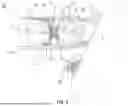 Fig. 04 - ARRANGEMENT WITH A RESPIRATORY MASK AND AN INTERMEDIATE PIECE, AND METHODS FOR OPERATING SUCH AN ARRANGEMENT
