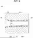 Fig. 04 - METHOD FOR MANUFACTURING CATHETER