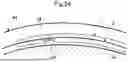 Fig. 25 - SURGICAL METHOD FOR DELIVERING DRUG SOLUTION TO MYOCARDIUM