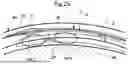 Fig. 26 - SURGICAL METHOD FOR DELIVERING DRUG SOLUTION TO MYOCARDIUM