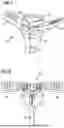 Fig. 05 - INTRODUCER SHEATH