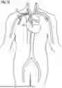 Fig. 09 - INTRODUCER SHEATH