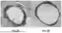 Fig. 08 - BALLOON CATHETER AND METHODS OF USING THE SAME