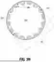 Fig. 11 - SUBMUCOSAL BIORESORBABLE DRUG ELUTING PLATFORM