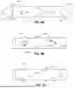 Fig. 12 - SUBMUCOSAL BIORESORBABLE DRUG ELUTING PLATFORM