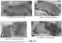 Fig. 22 - SUBMUCOSAL BIORESORBABLE DRUG ELUTING PLATFORM