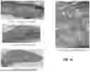 Fig. 24 - SUBMUCOSAL BIORESORBABLE DRUG ELUTING PLATFORM