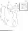 Fig. 02 - AORTOPULMONARY ELECTRICAL STIMULATOR-PRESSURE TRANSDUCER