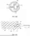 Fig. 06 - MEDICAL DEVICE FOR SENSING AND OR STIMULATING TISSUE