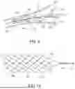 Fig. 07 - MEDICAL DEVICE FOR SENSING AND OR STIMULATING TISSUE