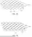 Fig. 09 - MEDICAL DEVICE FOR SENSING AND OR STIMULATING TISSUE