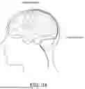 Fig. 25 - MEDICAL DEVICE FOR SENSING AND OR STIMULATING TISSUE