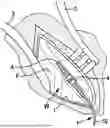 Fig. 01 - ANCHORING HOLDING TOOL