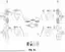 Fig. 16 - TREATMENT OF TISSUE USING ELECTRICAL STIMULATION