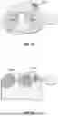 Fig. 46 - WEARABLE NEUROMODULATOR DEVICES