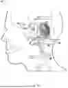Fig. 03 - DEVICES AND METHODS FOR TREATING MOTION SICKNESS USING ELECTRICAL STIMULATION