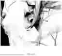 Fig. 21 - DEVICES AND METHODS FOR TREATING MOTION SICKNESS USING ELECTRICAL STIMULATION