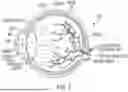 Fig. 06 - System and Method to Induce Epigenetic Changes to the Cells and Tissue of the Eye and Orbit