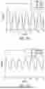 Fig. 13 - System and Method to Induce Epigenetic Changes to the Cells and Tissue of the Eye and Orbit