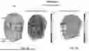 Fig. 18 - System and Method to Induce Epigenetic Changes to the Cells and Tissue of the Eye and Orbit