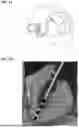 Fig. 05 - TREATMENT FOR LOSS OF CONTROL DISORDERS