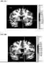 Fig. 13 - TREATMENT FOR LOSS OF CONTROL DISORDERS