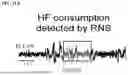 Fig. 30 - TREATMENT FOR LOSS OF CONTROL DISORDERS