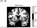 Fig. 43 - TREATMENT FOR LOSS OF CONTROL DISORDERS