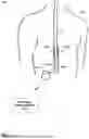 Fig. 02 - ELECTRICAL CONTACT FOR A MEDICAL DEVICE LEAD