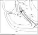Fig. 01 - BIOSTIMULATOR HAVING BURROWING NOSE