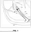 Fig. 02 - BIOSTIMULATOR HAVING BURROWING NOSE