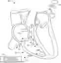 Fig. 01 - CROSSTALK PROTECTION FOR USE IN MULTI-CHAMBER LEADLESS PACEMAKER SYSTEMS