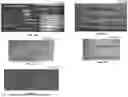 Fig. 03 - SIMULTANEOUS ULTRASONIC IMAGING AND LOW INTENSITY FOCUSED ULTRASOUND THERAPY