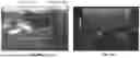Fig. 15 - SIMULTANEOUS ULTRASONIC IMAGING AND LOW INTENSITY FOCUSED ULTRASOUND THERAPY