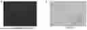 Fig. 16 - SIMULTANEOUS ULTRASONIC IMAGING AND LOW INTENSITY FOCUSED ULTRASOUND THERAPY