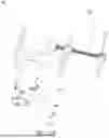 Fig. 27 - Joint Rotational Exercise and Stretching Tool