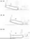 Fig. 04 - GOLF PUTTER HAVING FUNCTIONS OF COLLECTING AND RETURNING GOLF BALL AND BALL MARKER TO ORIGINAL POSITION