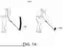 Fig. 11 - GOLF TRAINING DEVICE AND METHOD THEREOF
