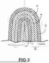 Fig. 04 - PLEATED FLUID FILTER ELEMENT AND METHODS