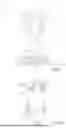 Fig. 02 - JET NOZZLE HAVING A POWDER SECTION AND AN ADVANCE SECTION