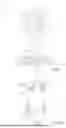 Fig. 02 - JET NOZZLE HAVING AN ABSORPTION PORTION FOR ABSORBING BACK-REFLECTED RADIATION