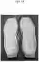 Fig. 40 - APPARATUS AND METHOD FOR PHYSICAL FOAMING INJECTION