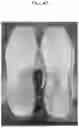 Fig. 43 - APPARATUS AND METHOD FOR PHYSICAL FOAMING INJECTION