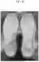 Fig. 44 - APPARATUS AND METHOD FOR PHYSICAL FOAMING INJECTION