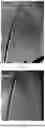 Fig. 04 - ASYMMETRIC LAMINATED GLASS AND MANUFACTURING METHOD THEREFOR AND USE THEREOF