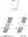 Fig. 04 - RESONANT FREQUENCY BASED BELT TIGHTNESS/SLACK VERIFICATION DEVICE