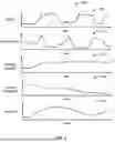Fig. 06 - SYSTEMS AND METHODS FOR DETECTING VEHICLE COLLISIONS