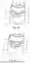 Fig. 06 - PACKAGING DEVICE WITH CONTAINER WITH THREADED NECK AND SCREW CLOSURE MEMBER