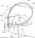 Fig. 01 - CABLE TIE FINGER MANIPULATION STRUCTURE